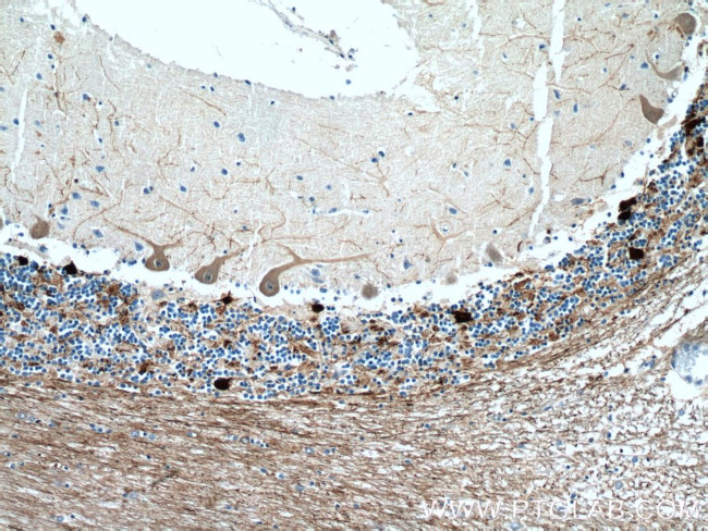 Calretinin Antibody in Immunohistochemistry (Paraffin) (IHC (P))