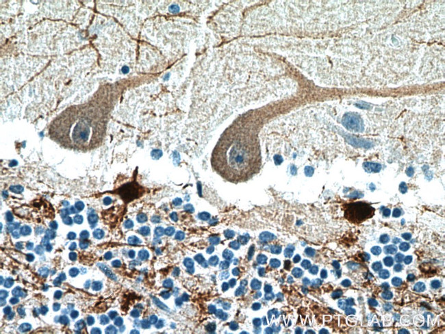 Calretinin Antibody in Immunohistochemistry (Paraffin) (IHC (P))