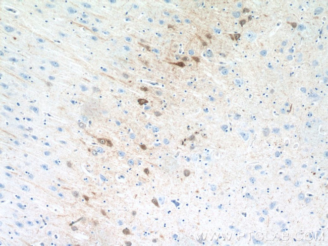 Calretinin Antibody in Immunohistochemistry (Paraffin) (IHC (P))