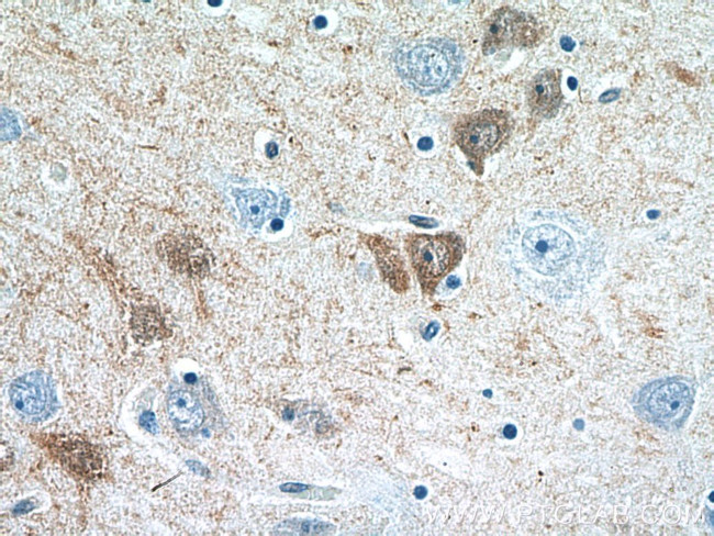 Calretinin Antibody in Immunohistochemistry (Paraffin) (IHC (P))