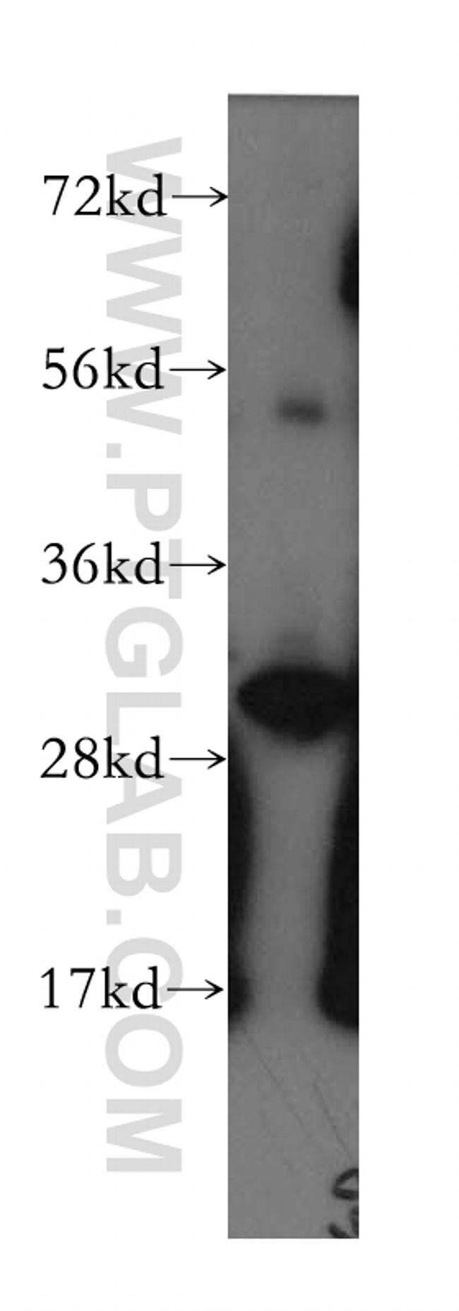 Calretinin Antibody in Western Blot (WB)