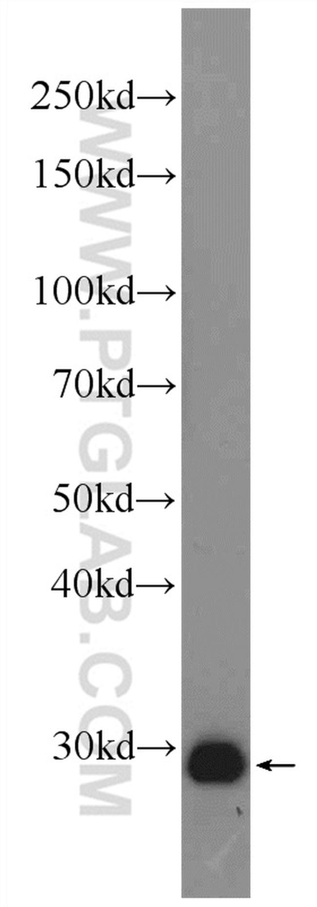 Calretinin Antibody in Western Blot (WB)