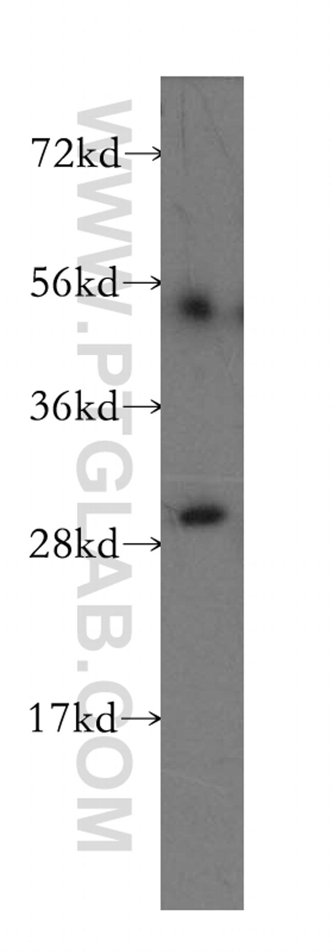 Calretinin Antibody in Western Blot (WB)