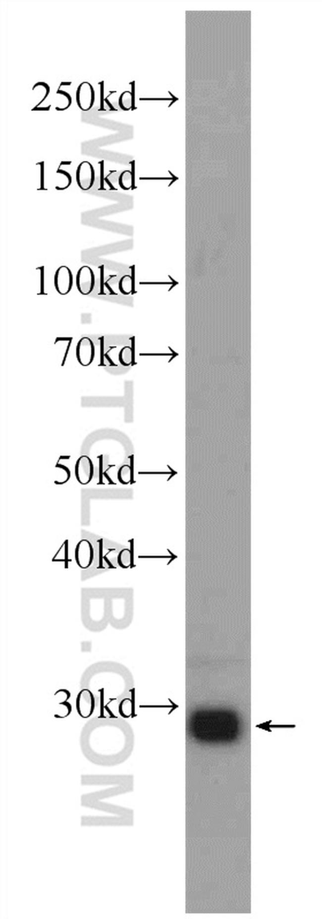 Calretinin Antibody in Western Blot (WB)