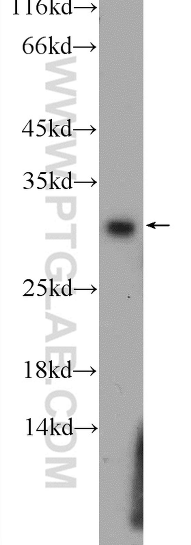 Calretinin Antibody in Western Blot (WB)