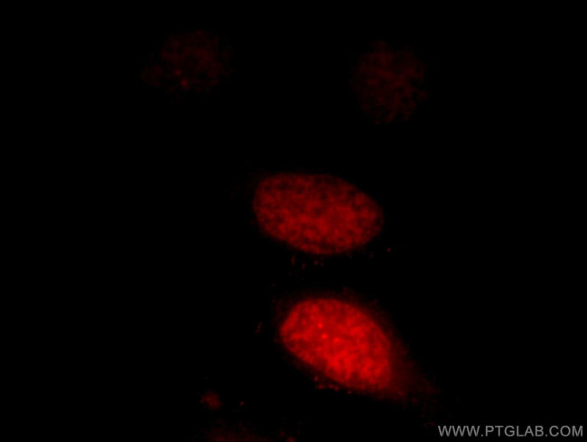 LEO1 Antibody in Immunocytochemistry (ICC/IF)