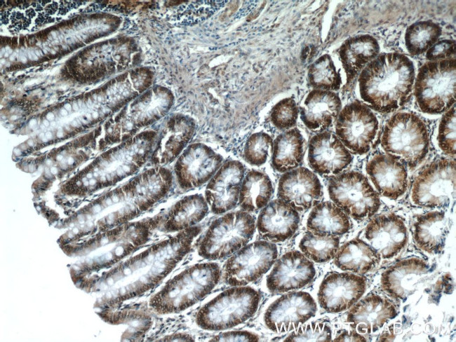 LEO1 Antibody in Immunohistochemistry (Paraffin) (IHC (P))