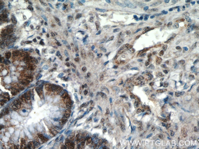 LEO1 Antibody in Immunohistochemistry (Paraffin) (IHC (P))