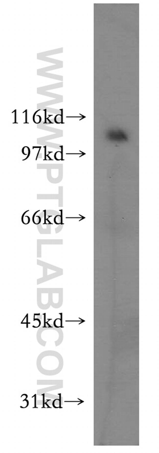 LEO1 Antibody in Western Blot (WB)