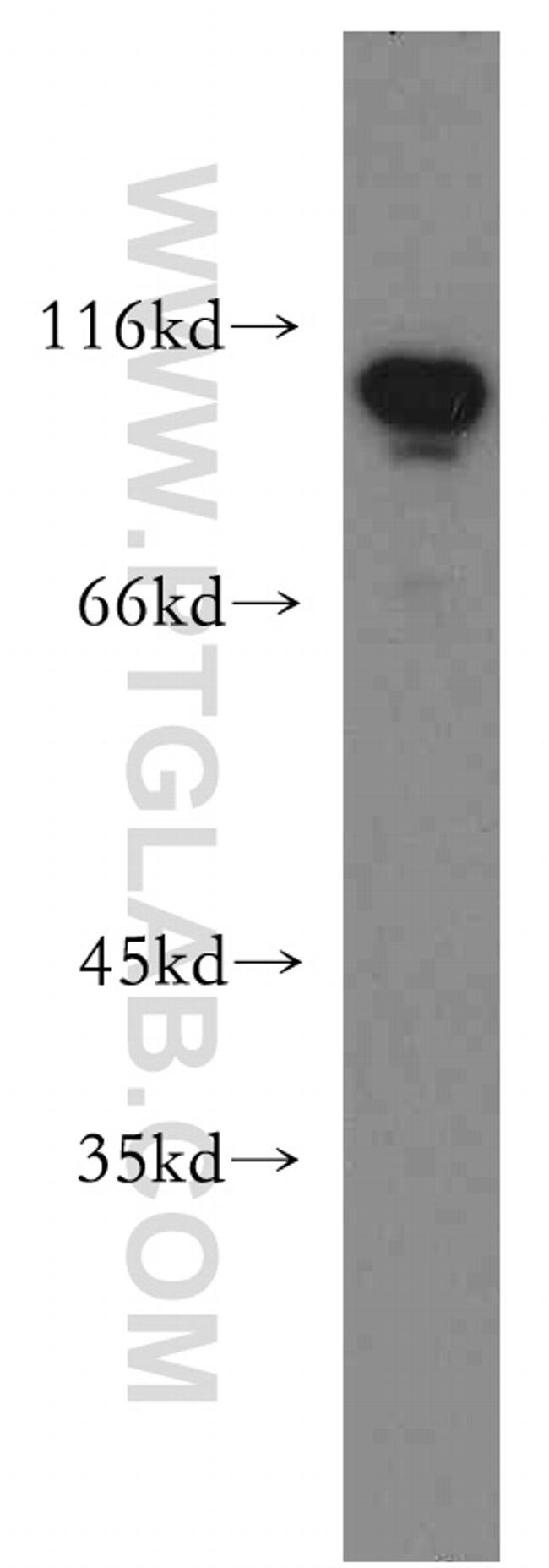 LEO1 Antibody in Western Blot (WB)