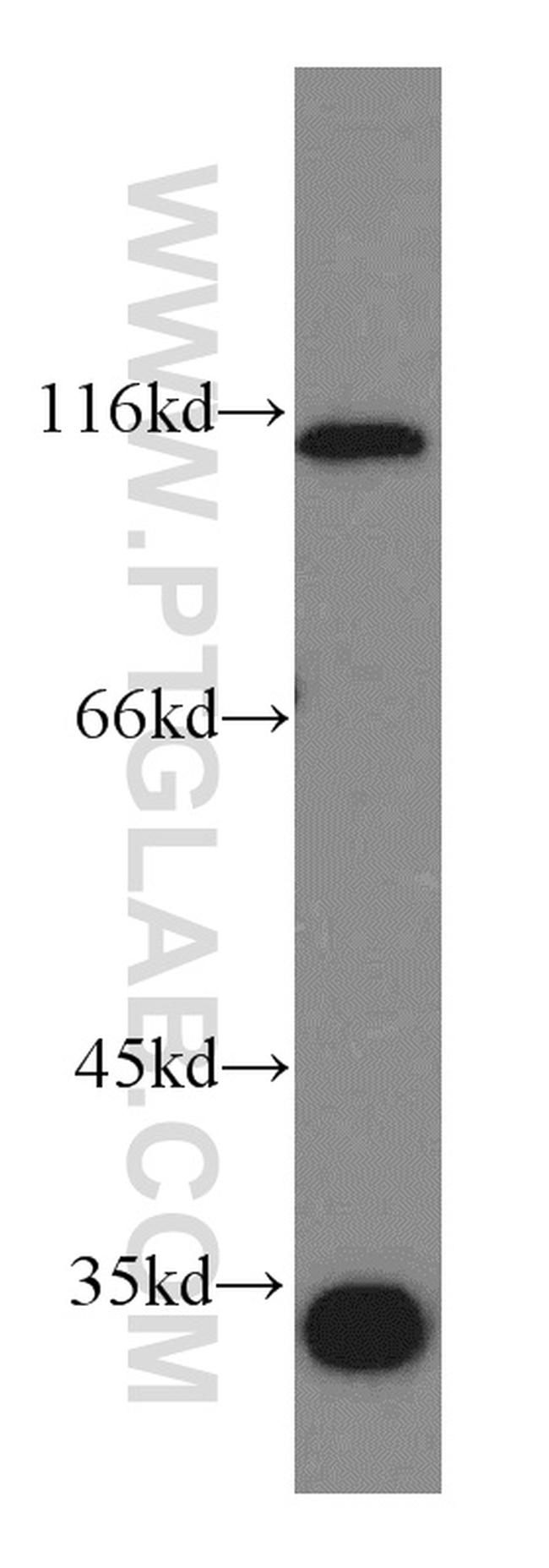 LEO1 Antibody in Western Blot (WB)