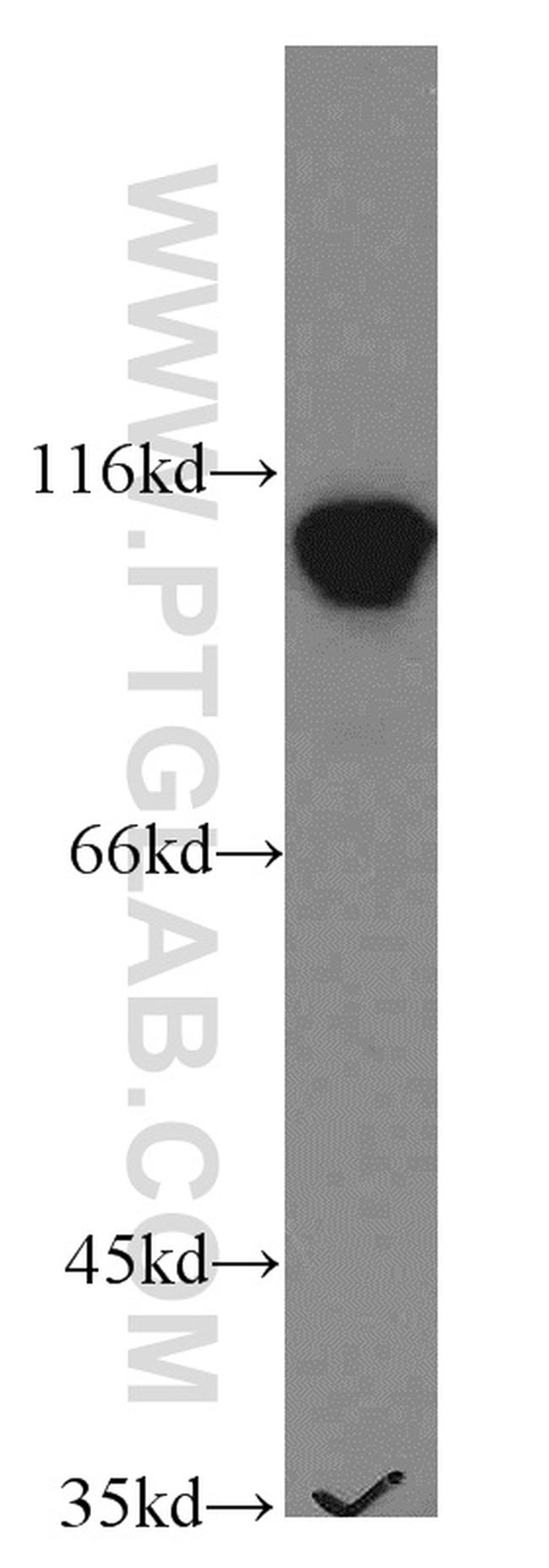 LEO1 Antibody in Western Blot (WB)