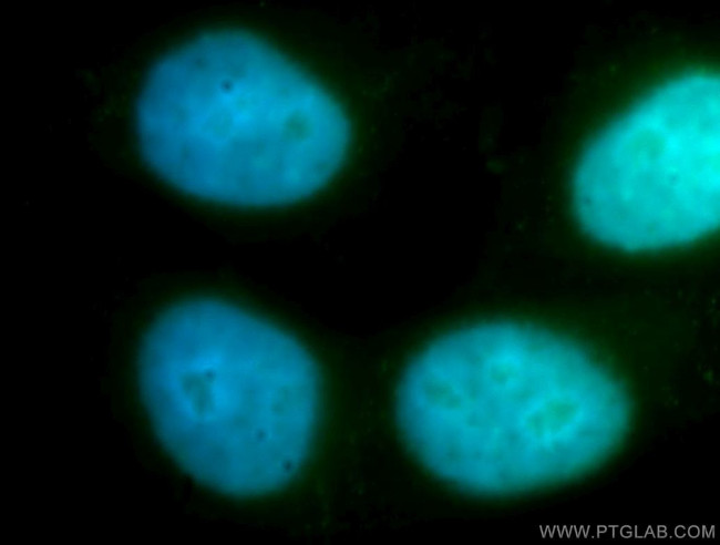 ZWINT Antibody in Immunocytochemistry (ICC/IF)