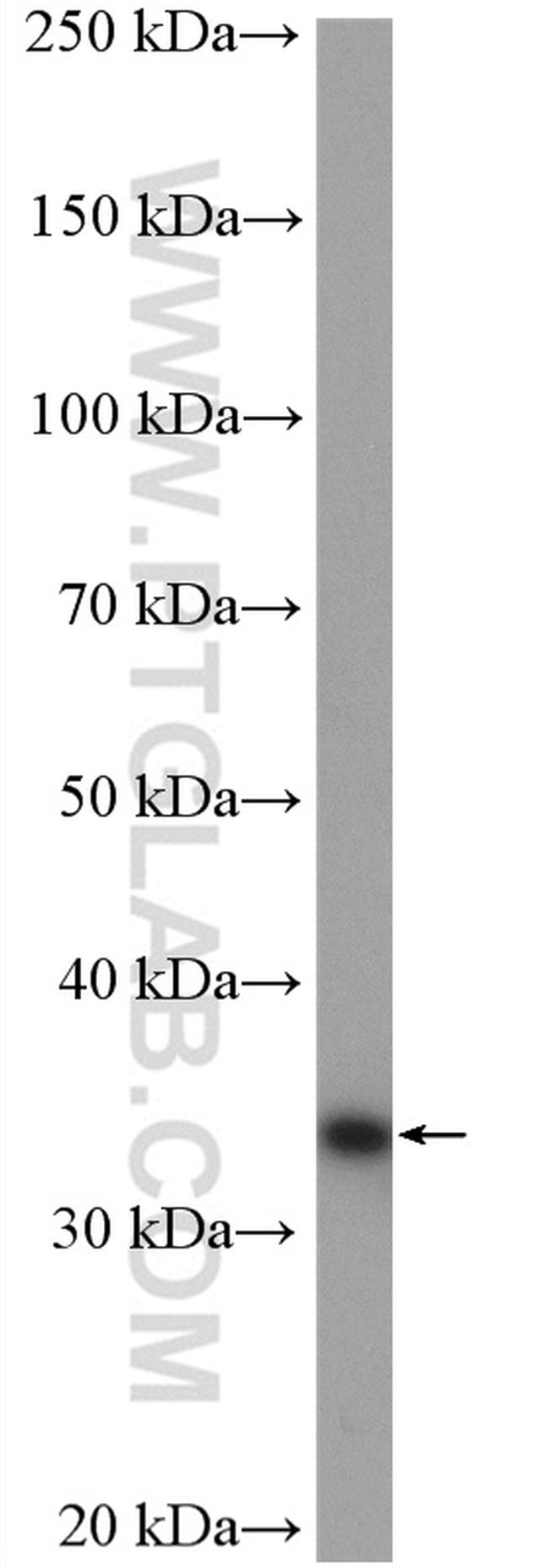 ZWINT Antibody in Western Blot (WB)