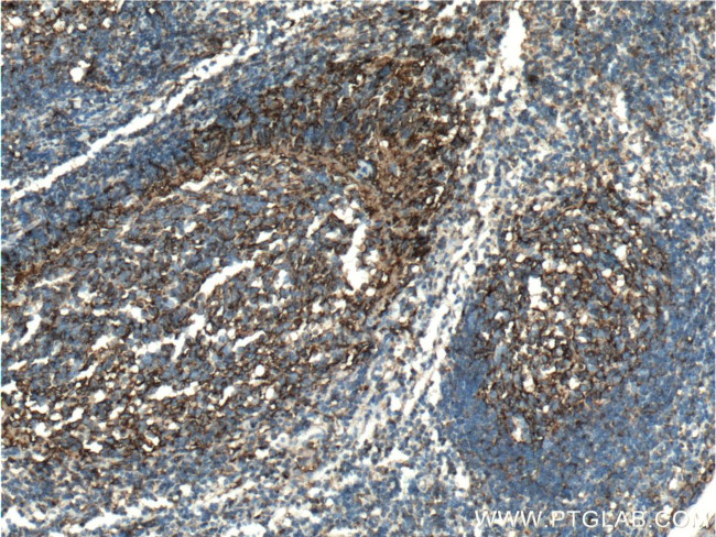 Clusterin Antibody in Immunohistochemistry (Paraffin) (IHC (P))