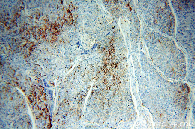 Clusterin Antibody in Immunohistochemistry (Paraffin) (IHC (P))