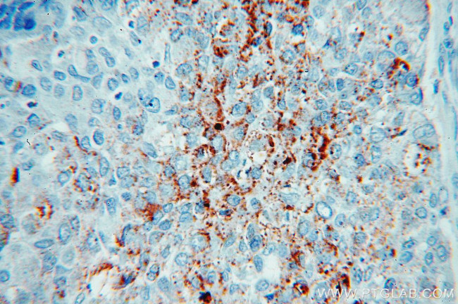 Clusterin Antibody in Immunohistochemistry (Paraffin) (IHC (P))