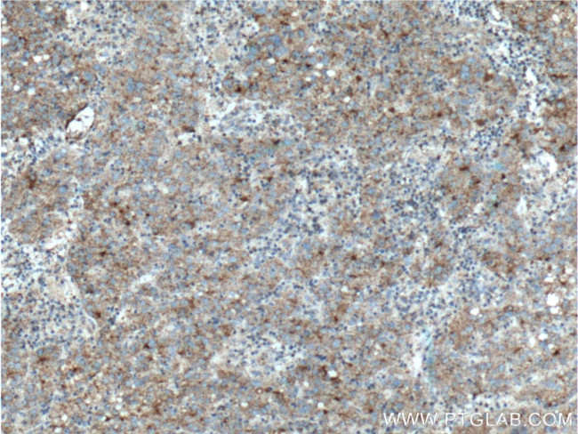 Clusterin Antibody in Immunohistochemistry (Paraffin) (IHC (P))