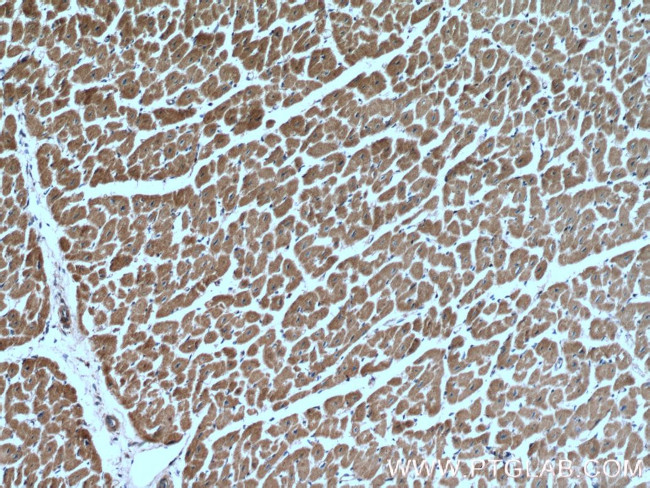 Prohibitin 2 Antibody in Immunohistochemistry (Paraffin) (IHC (P))