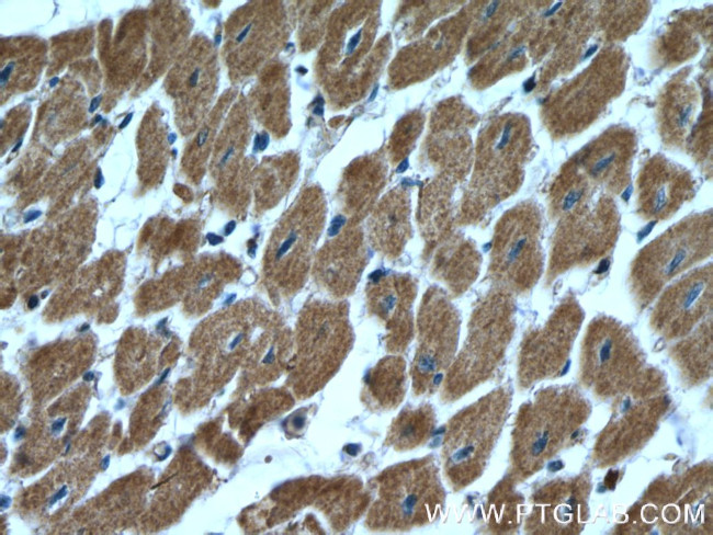 Prohibitin 2 Antibody in Immunohistochemistry (Paraffin) (IHC (P))