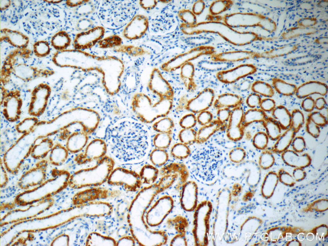 SFXN1 Antibody in Immunohistochemistry (Paraffin) (IHC (P))