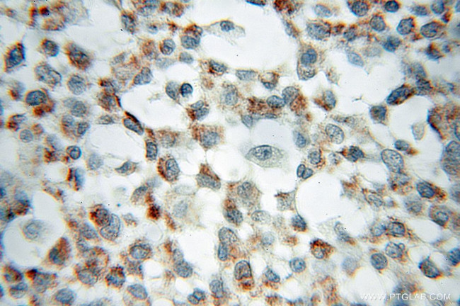 SFXN1 Antibody in Immunohistochemistry (Paraffin) (IHC (P))