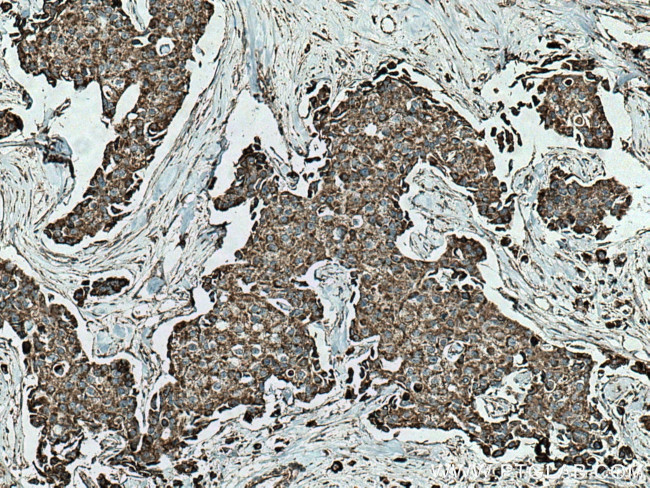 SFXN1 Antibody in Immunohistochemistry (Paraffin) (IHC (P))