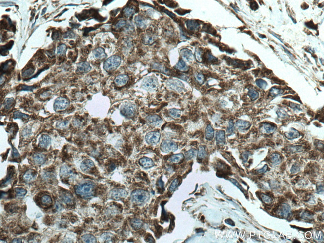 SFXN1 Antibody in Immunohistochemistry (Paraffin) (IHC (P))