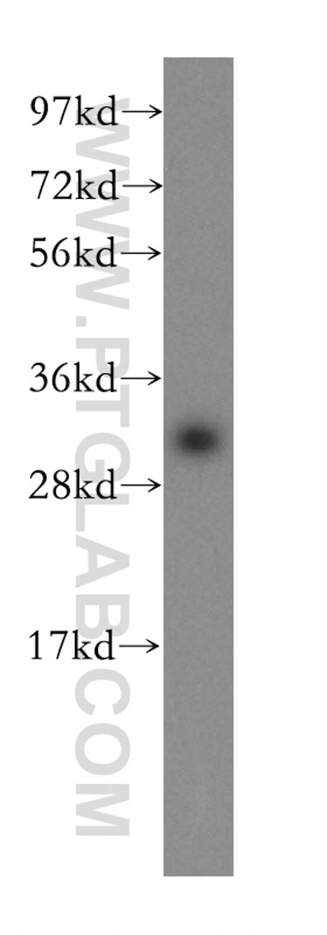 SFXN1 Antibody in Western Blot (WB)