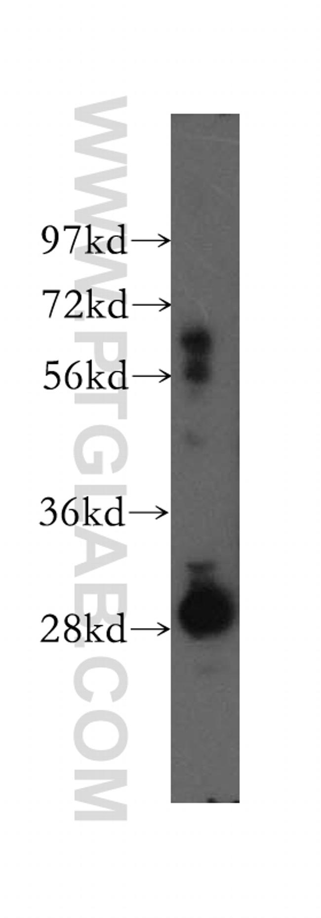 SFXN1 Antibody in Western Blot (WB)