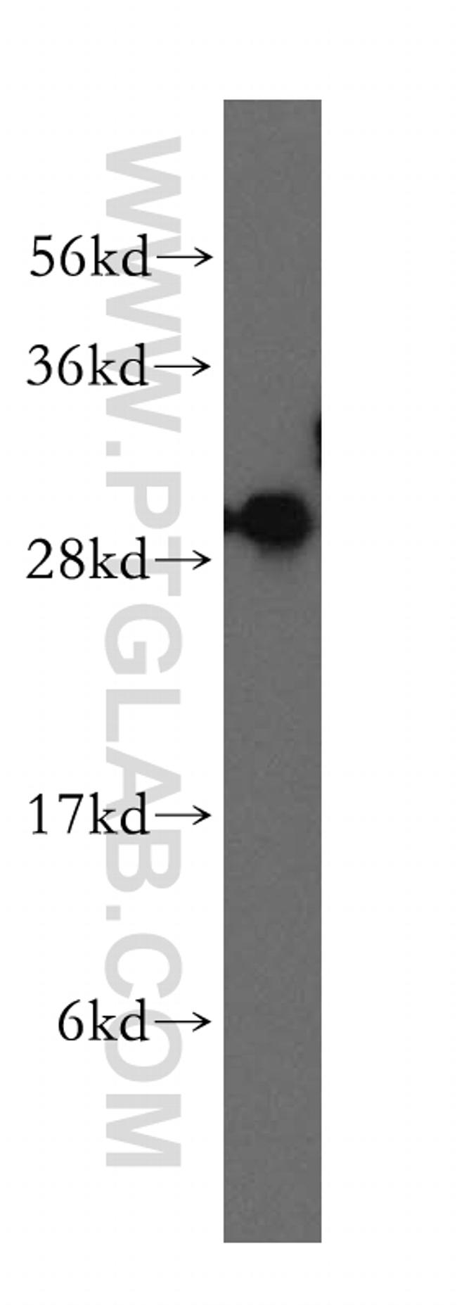 SFXN1 Antibody in Western Blot (WB)