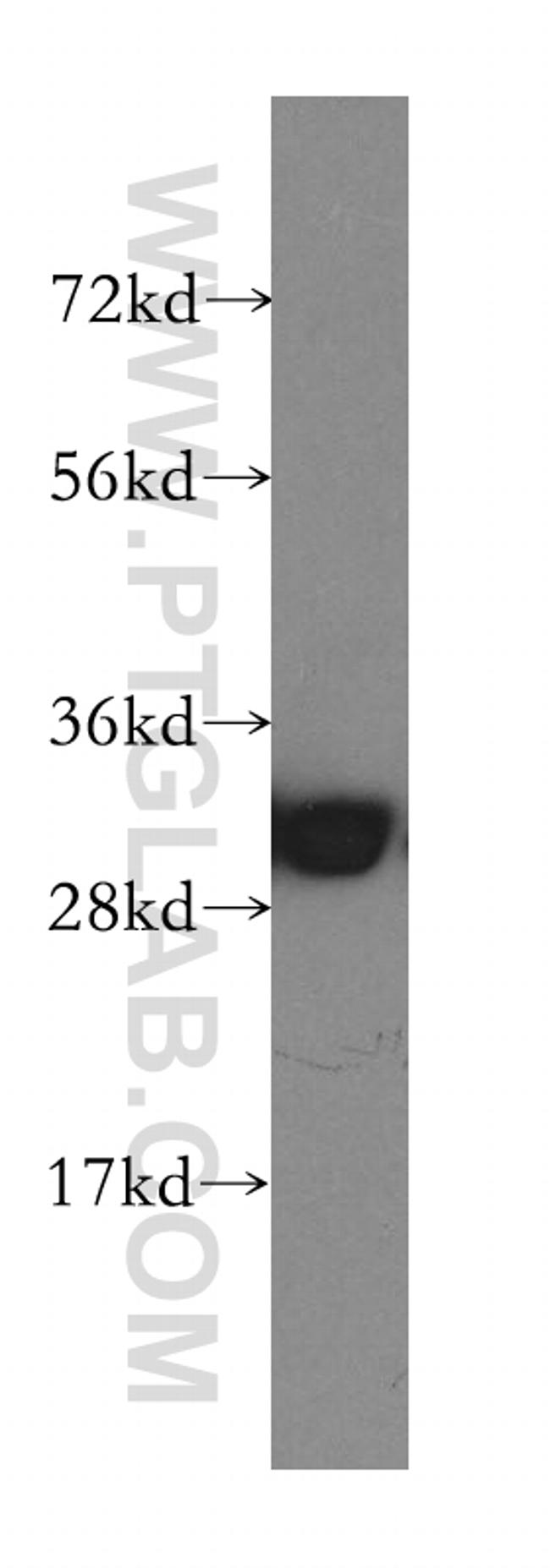 SFXN1 Antibody in Western Blot (WB)