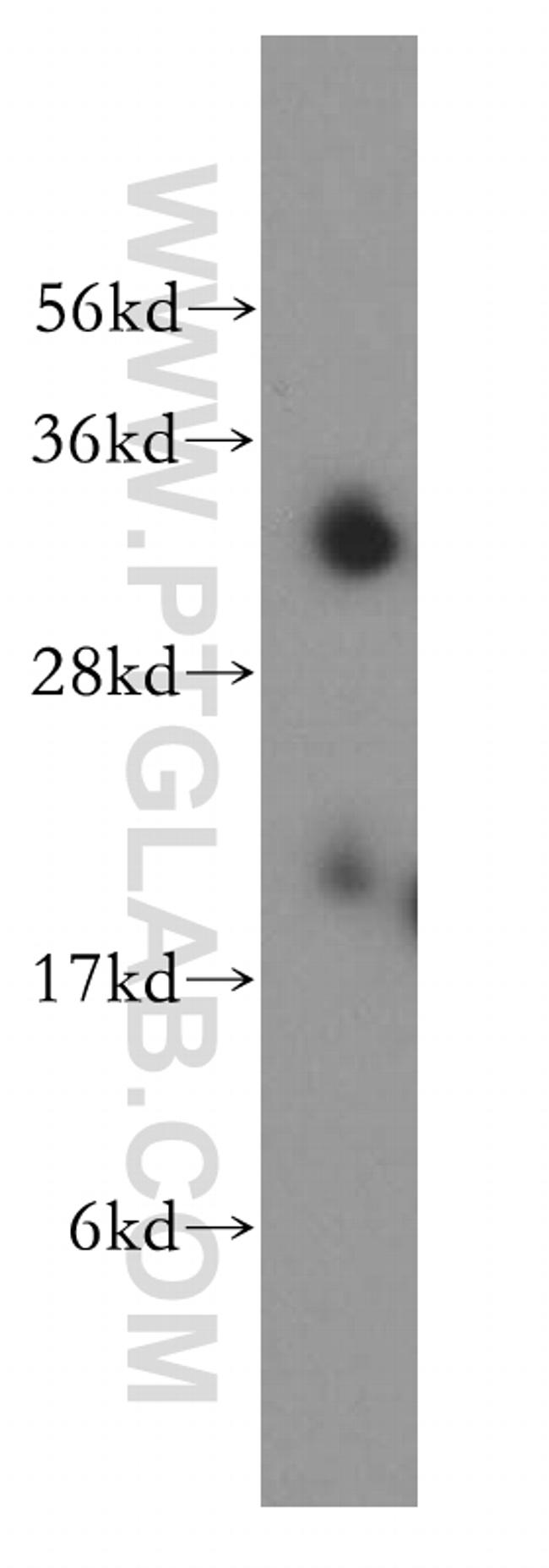 SFXN1 Antibody in Western Blot (WB)