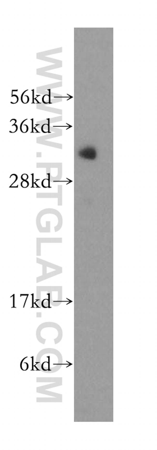 SFXN1 Antibody in Western Blot (WB)