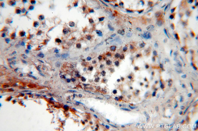 Neurotrophin 4 Antibody in Immunohistochemistry (Paraffin) (IHC (P))