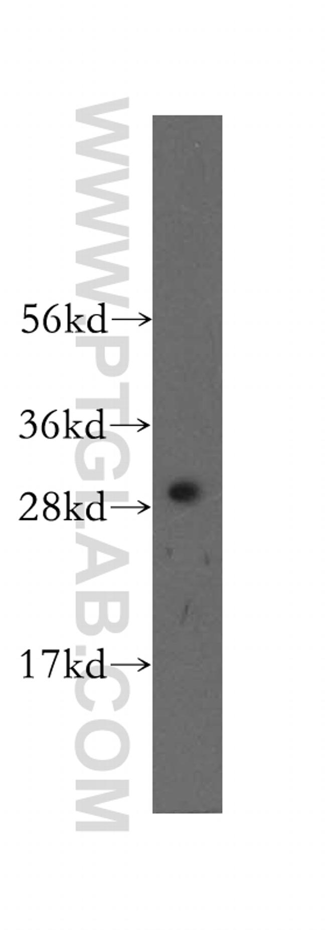 CLIC4 Antibody in Western Blot (WB)