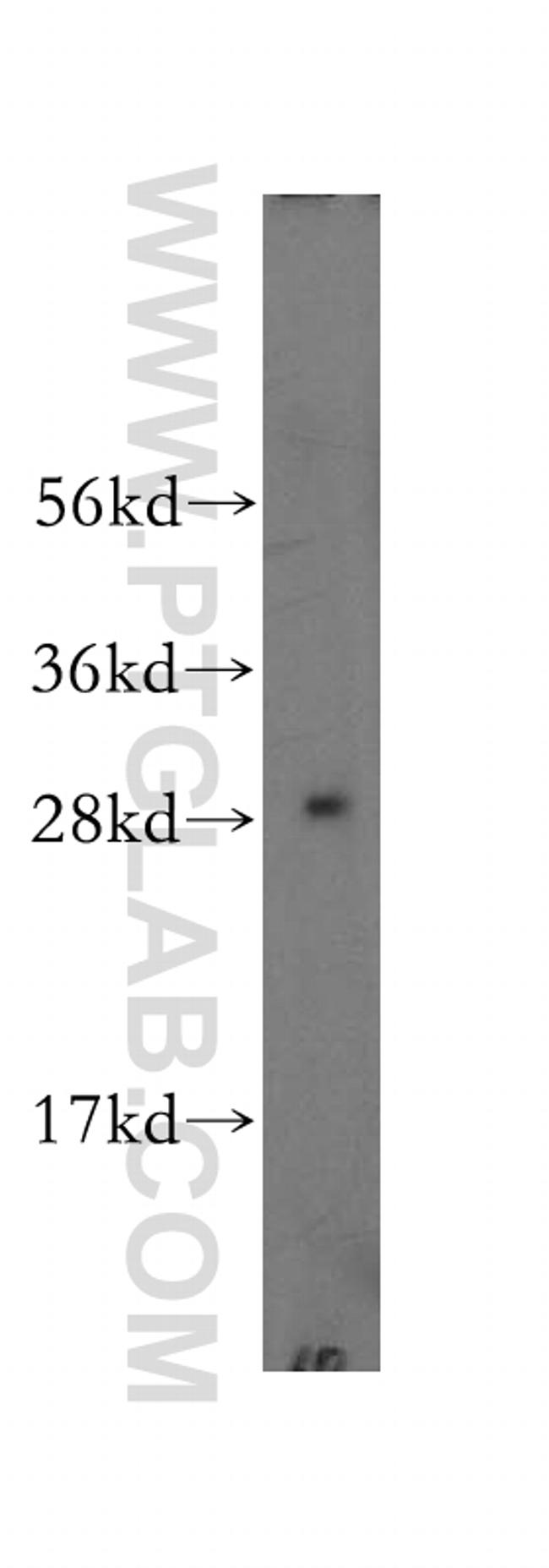 CLIC4 Antibody in Western Blot (WB)