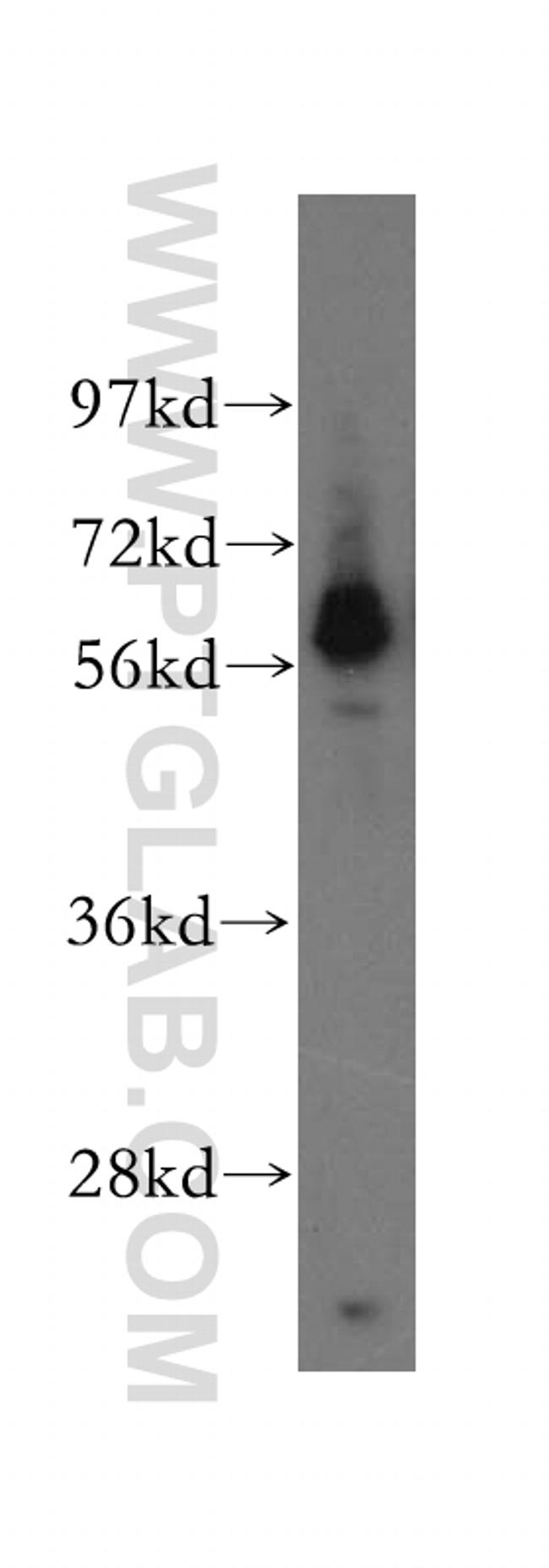 MTMR8 Antibody in Western Blot (WB)