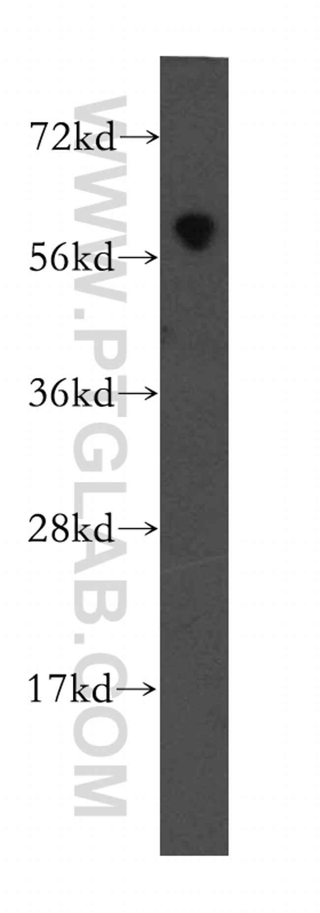 MTMR8 Antibody in Western Blot (WB)