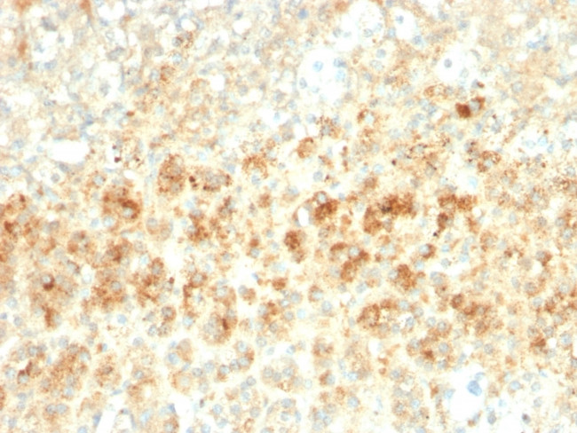 Adipophilin/Perilipin-2 Antibody in Immunohistochemistry (Paraffin) (IHC (P))