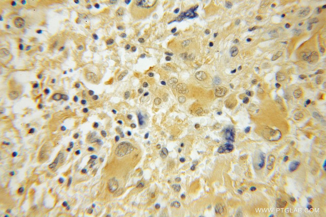 ACYP2 Antibody in Immunohistochemistry (Paraffin) (IHC (P))