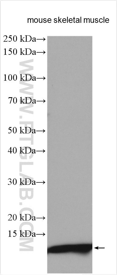 ACYP2 Antibody in Western Blot (WB)