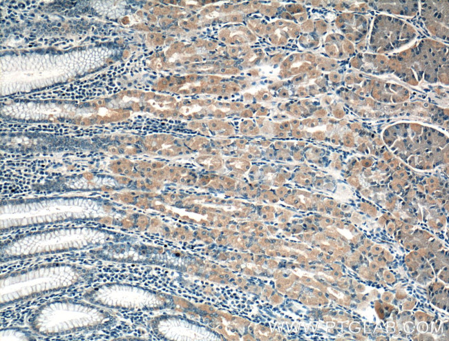 PDCD6 Antibody in Immunohistochemistry (Paraffin) (IHC (P))