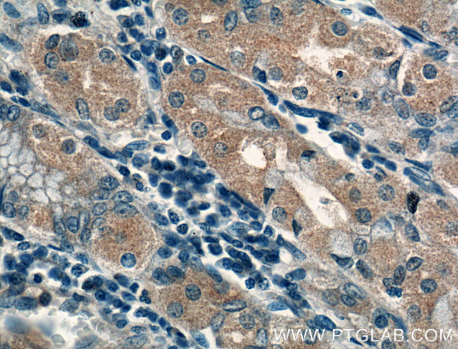 PDCD6 Antibody in Immunohistochemistry (Paraffin) (IHC (P))