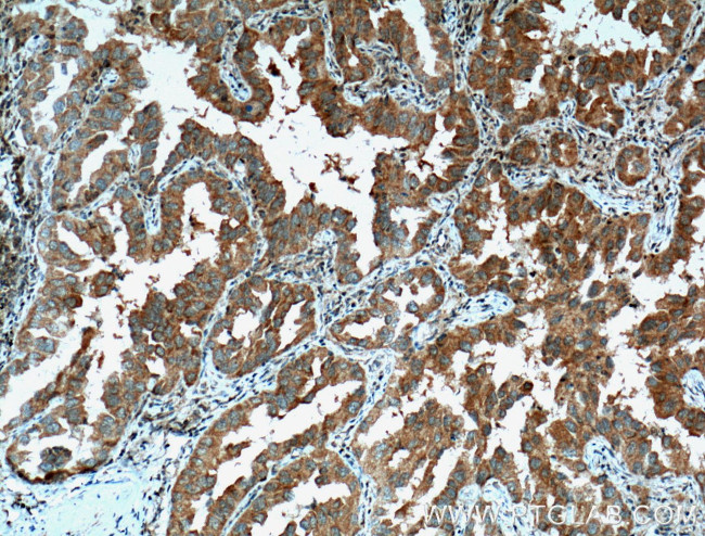 PDCD6 Antibody in Immunohistochemistry (Paraffin) (IHC (P))