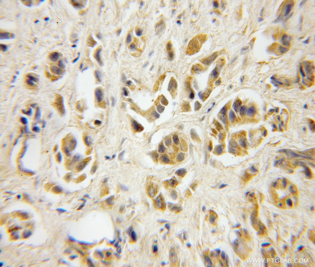 TBCA Antibody in Immunohistochemistry (Paraffin) (IHC (P))