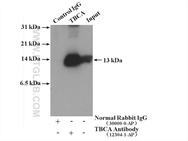 TBCA Antibody in Immunoprecipitation (IP)