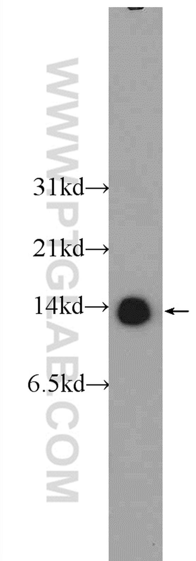 TBCA Antibody in Western Blot (WB)