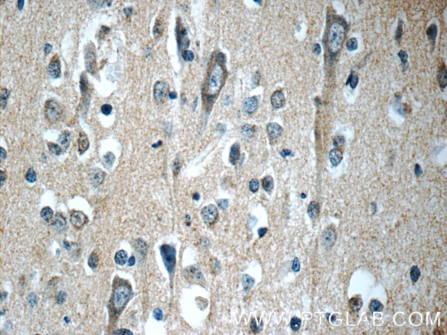 APLP1 Antibody in Immunohistochemistry (Paraffin) (IHC (P))