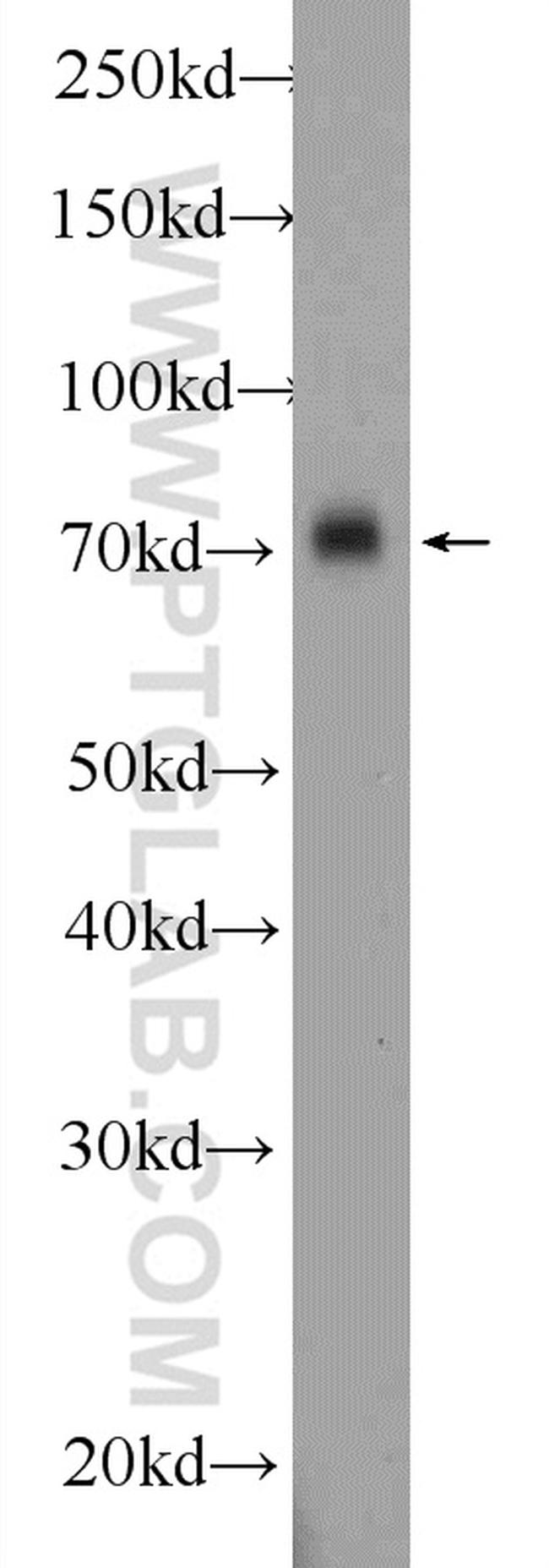 APLP1 Antibody in Western Blot (WB)